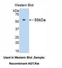 大鼠血管紧张素原(AGT)多克隆抗体