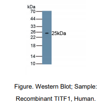 人甲状腺转录因子1(TITF1)多克隆抗体