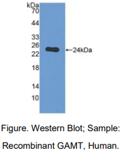 https://msimg.bioon.com/bionline/goods-no-pic.png