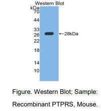 https://msimg.bioon.com/bionline/goods-no-pic.png