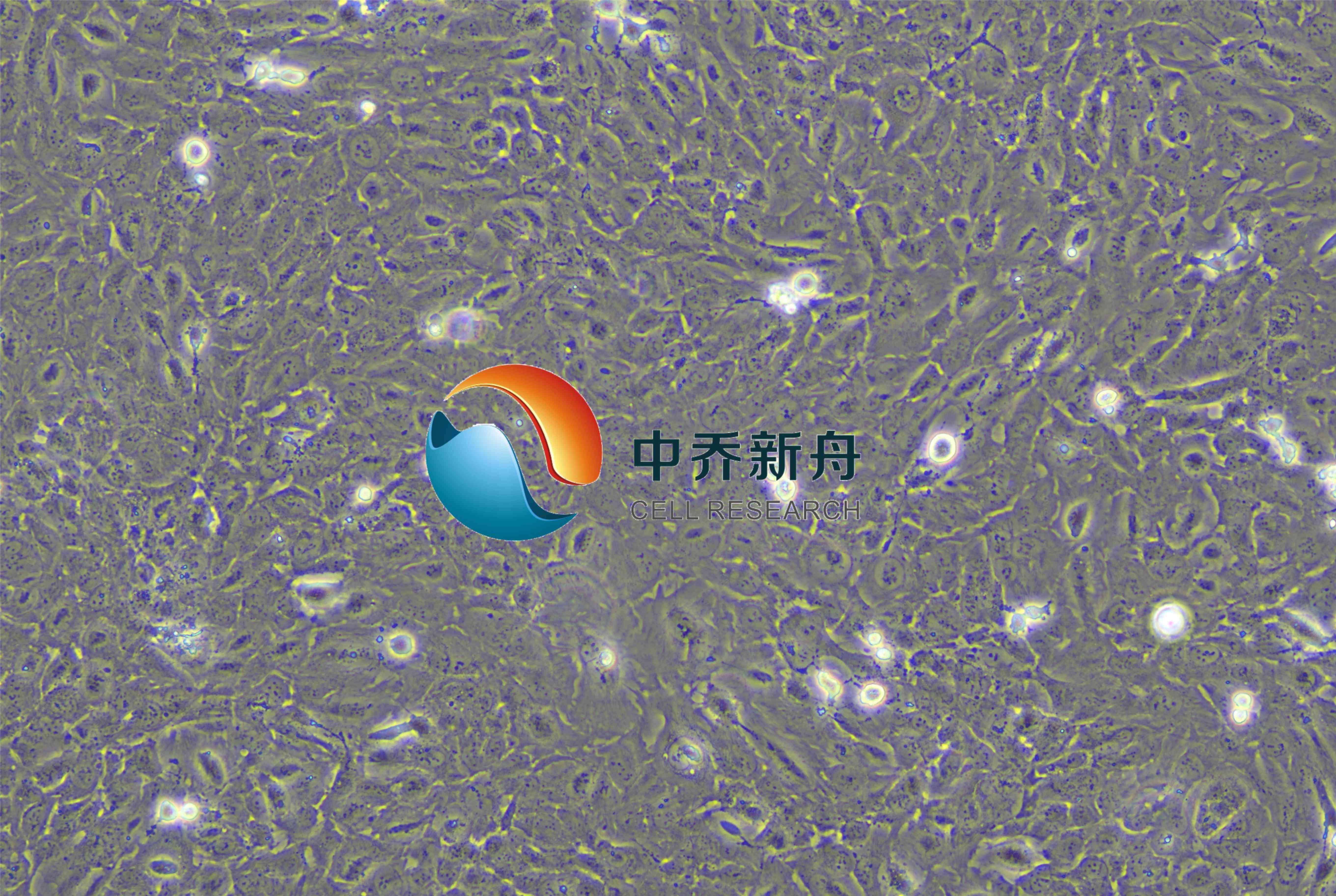 人视网膜星形胶质细胞-永生化