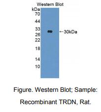 https://msimg.bioon.com/bionline/goods-no-pic.png