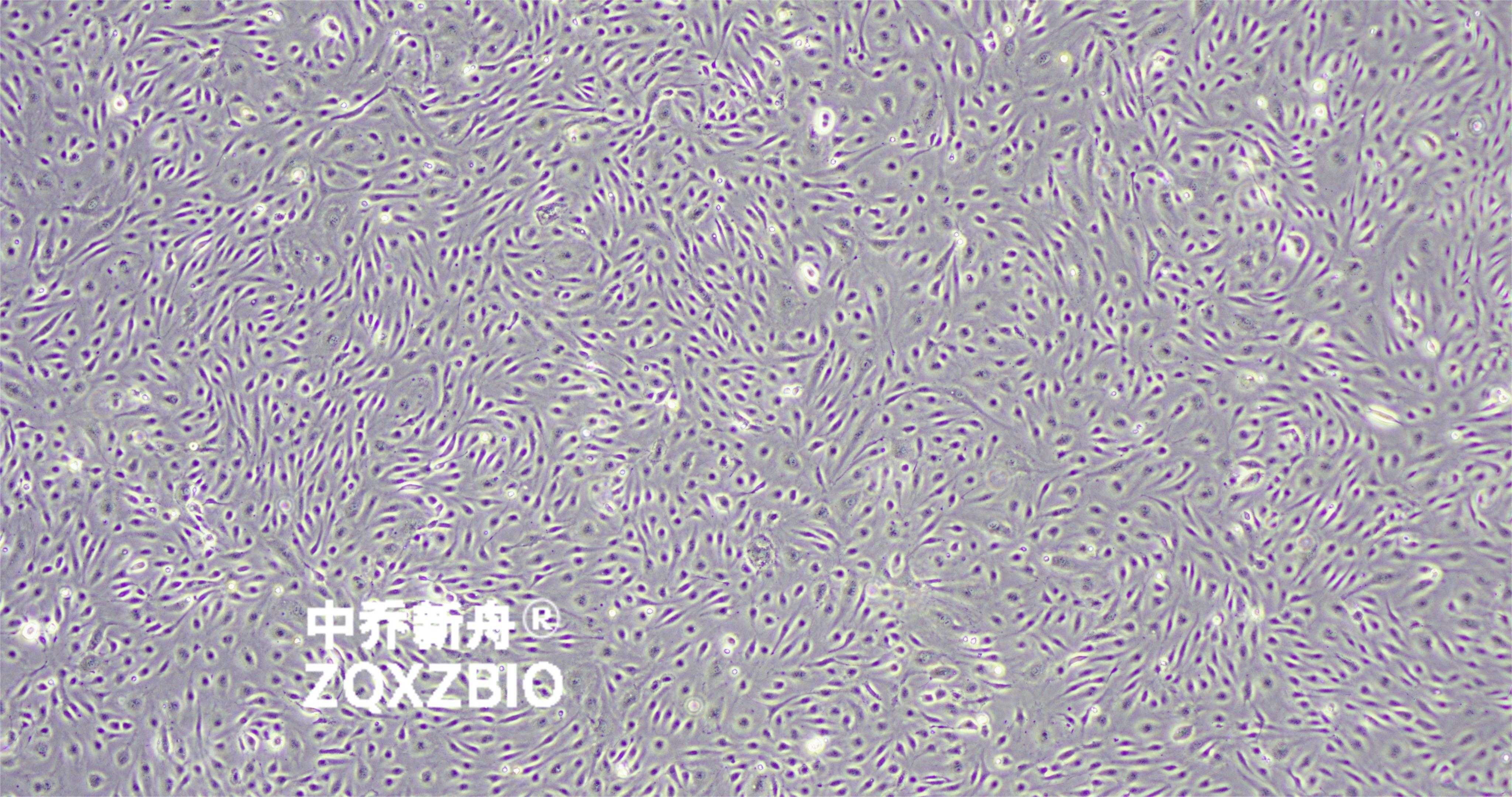 人脐静脉内皮细胞huvec-原代(提供伦理及鉴定)