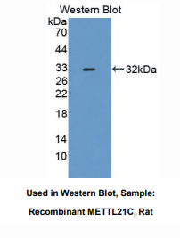 大鼠甲基转移酶样蛋白21C(METTL21C)多克隆抗体