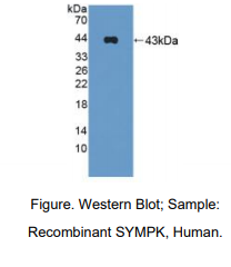 人偶对蛋白(SYMPK)多克隆抗体
