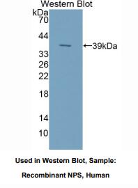 https://msimg.bioon.com/bionline/goods-no-pic.png