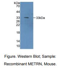 https://msimg.bioon.com/bionline/goods-no-pic.png