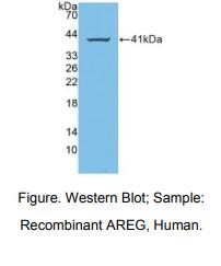 https://msimg.bioon.com/bionline/goods-no-pic.png