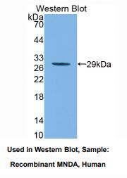 https://msimg.bioon.com/bionline/goods-no-pic.png