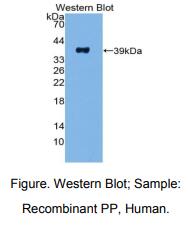 https://msimg.bioon.com/bionline/goods-no-pic.png