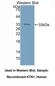 人驱动结合蛋白1(KTN1)多克隆抗体