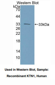 https://msimg.bioon.com/bionline/goods-no-pic.png