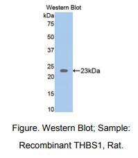 https://msimg.bioon.com/bionline/goods-no-pic.png