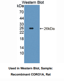 https://msimg.bioon.com/bionline/goods-no-pic.png