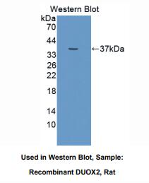 https://msimg.bioon.com/bionline/goods-no-pic.png