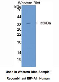 人真核翻译起始因子4A1(EIF4A1)多克隆抗体