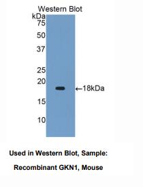 https://msimg.bioon.com/bionline/goods-no-pic.png