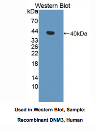 https://msimg.bioon.com/bionline/goods-no-pic.png