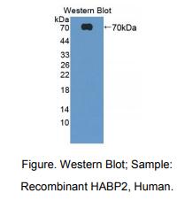 人透明质酸结合蛋白2(HABP2)多克隆抗体