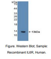 人白介素6受体(IL6R)多克隆抗体