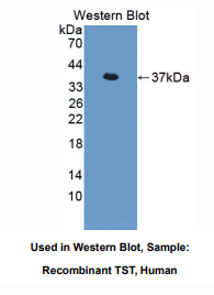 人硫代硫酸盐转硫酶(TST)多克隆抗体