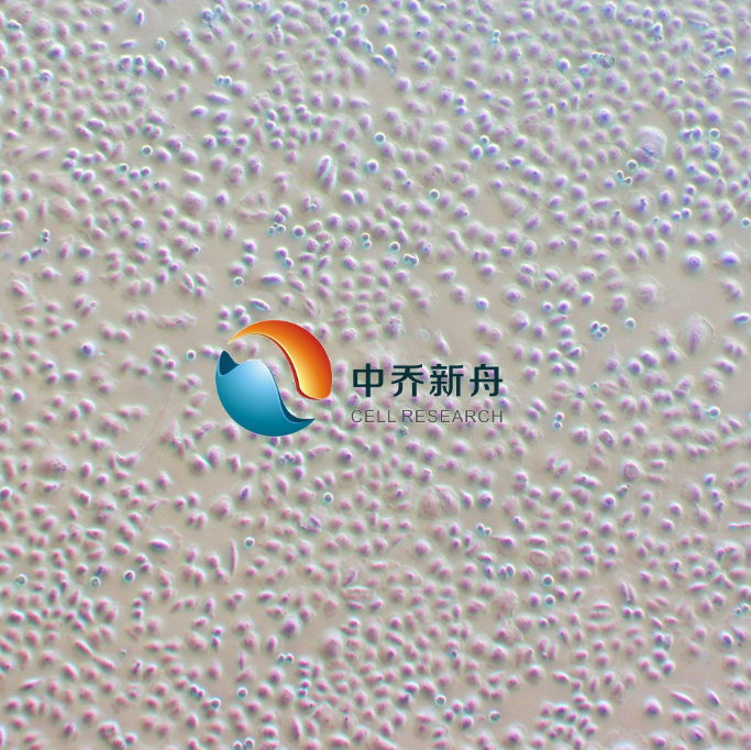 人肺癌细胞