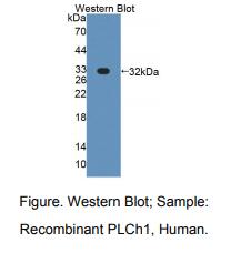 https://msimg.bioon.com/bionline/goods-no-pic.png