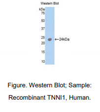 人骨骼肌慢肌肌钙蛋白I(TNNI1)多克隆抗体