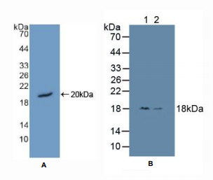 人高迁移率族核小体结合域蛋白1(HMGN1)多克隆抗体