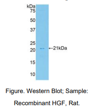 https://msimg.bioon.com/bionline/goods-no-pic.png