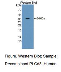 人磷酯酶Cδ3(PLCd3)多克隆抗体