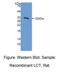 https://msimg.bioon.com/bionline/goods-no-pic.png