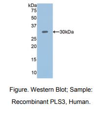 人丝束蛋白3(PLS3)多克隆抗体