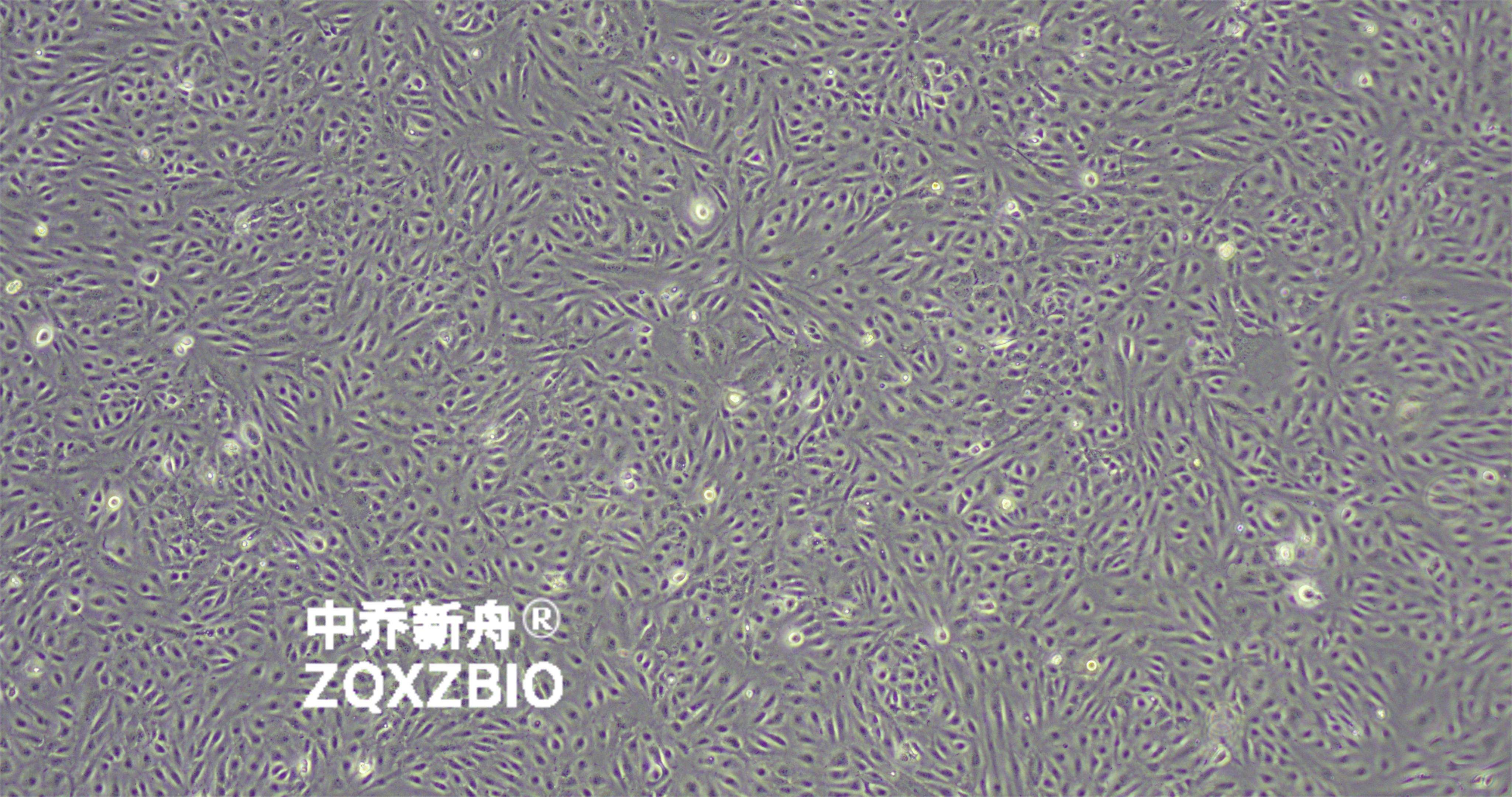 人心脏微血管内皮细胞-永生化