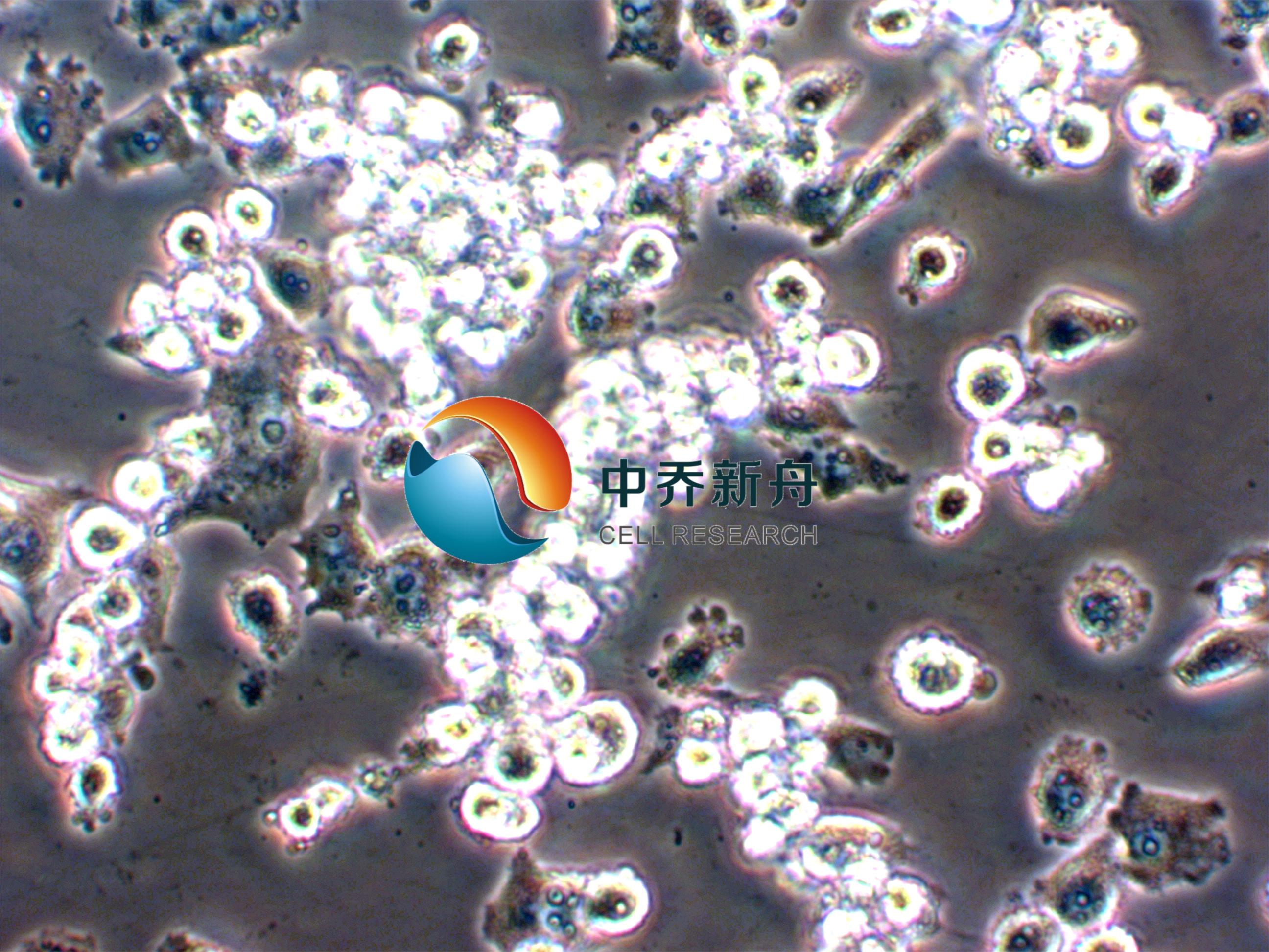 https://img.medsci.cn/8eee53bbc4cb7a98de615e72115896bc4e27fda5cbb764dbd67d9d641c2bb46a.png