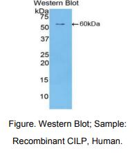 人软骨中间层蛋白(CILP)多克隆抗体