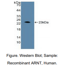 https://msimg.bioon.com/bionline/goods-no-pic.png