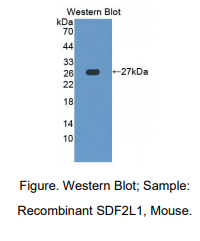 https://msimg.bioon.com/bionline/goods-no-pic.png