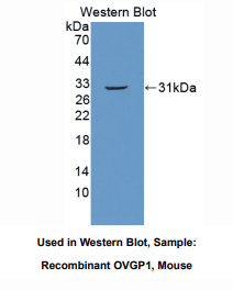 https://msimg.bioon.com/bionline/goods-no-pic.png