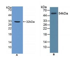 人岩藻糖苷酶αL1(FUCa1)多克隆抗体