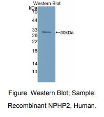人肾结核蛋白2(NPHP2)多克隆抗体