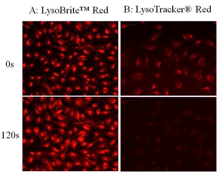 https://img.medsci.cn/e73eefcea40976357f460123cbf1e819c54e5106c9b457225be13b1cbc991aff.png