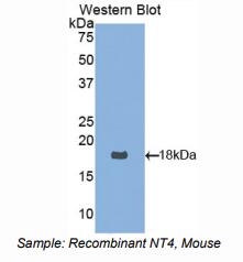 https://msimg.bioon.com/bionline/goods-no-pic.png