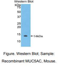 https://msimg.bioon.com/bionline/goods-no-pic.png