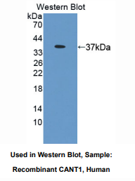 https://msimg.bioon.com/bionline/goods-no-pic.png