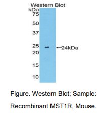 https://msimg.bioon.com/bionline/goods-no-pic.png