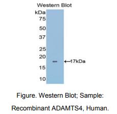 https://msimg.bioon.com/bionline/goods-no-pic.png