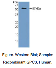 人磷脂酰肌醇蛋白聚糖3(GPC3)多克隆抗体