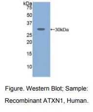 人失调蛋白1(ATXN1)多克隆抗体