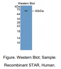 https://msimg.bioon.com/bionline/goods-no-pic.png